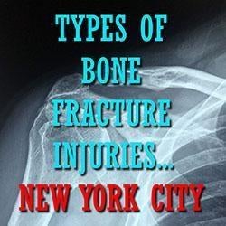 Types of Bone Fracture Injuries